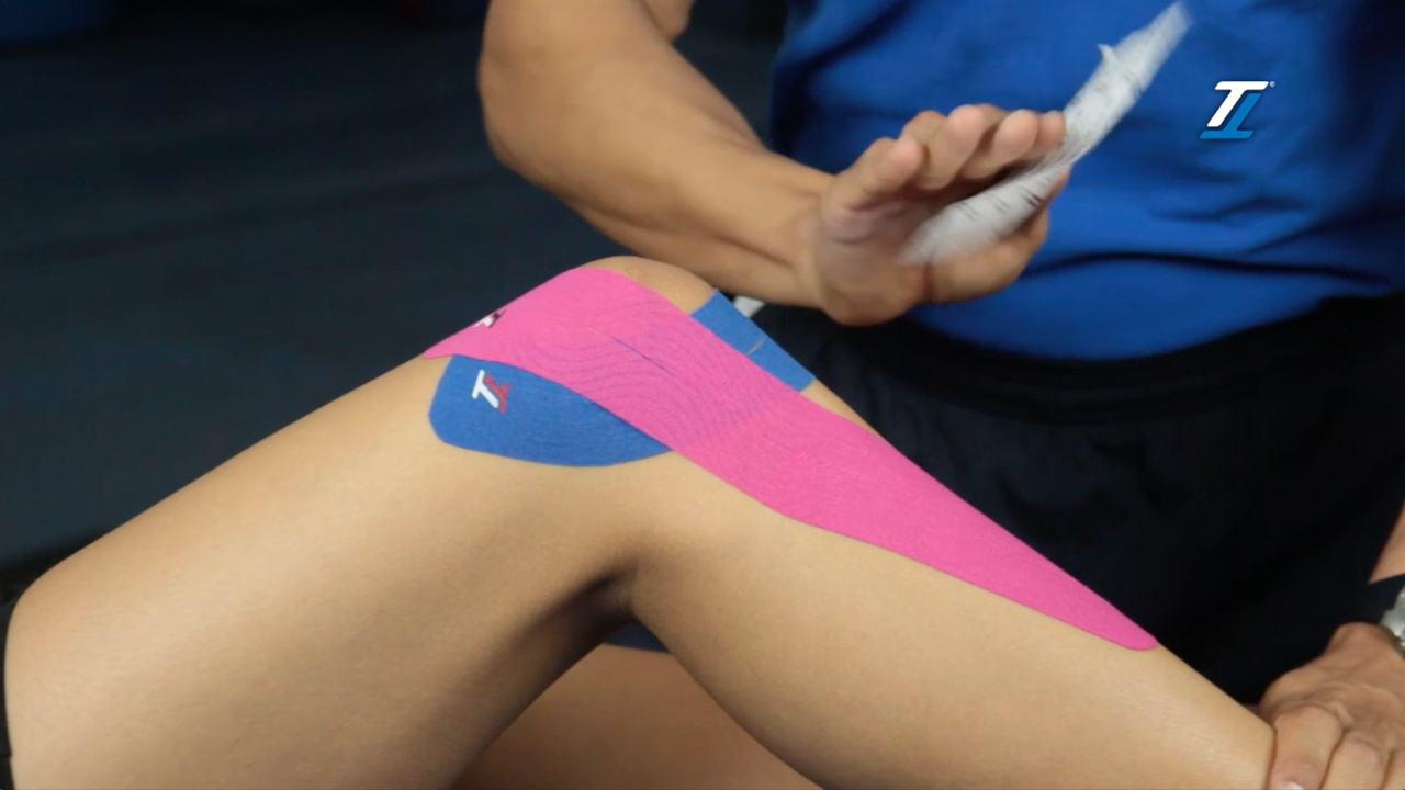 Ligamento lateral de rodilla | Target Tape